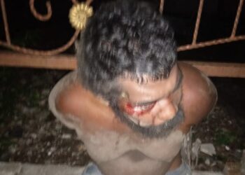Balbo (ODGJ) Jadi Sayur Lode Diduga Dihajar Babak Belur Oknum Polisi